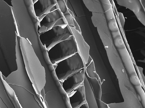 Mikroskop Bild Zellstruktur Pflanzenkohle
